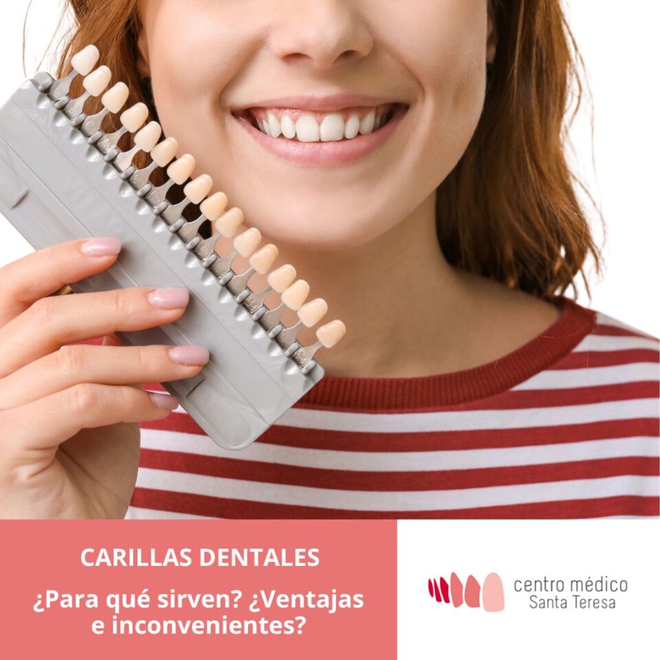 carillas dentales barakaldo